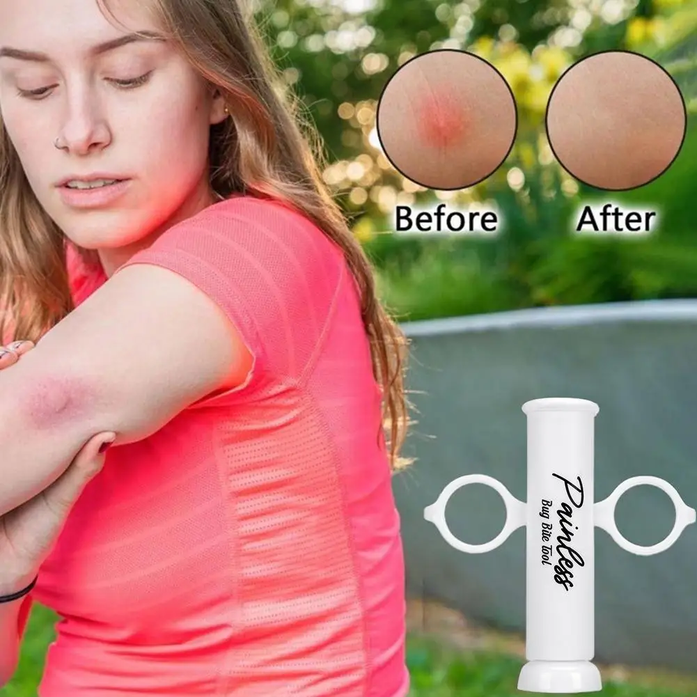 Bug Bite Suction Tool Venom Ex - Field Dressing Kit recensie en prijs